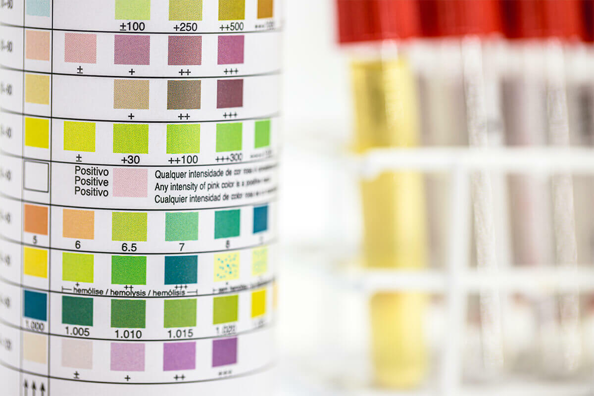 drug testing positivity scale