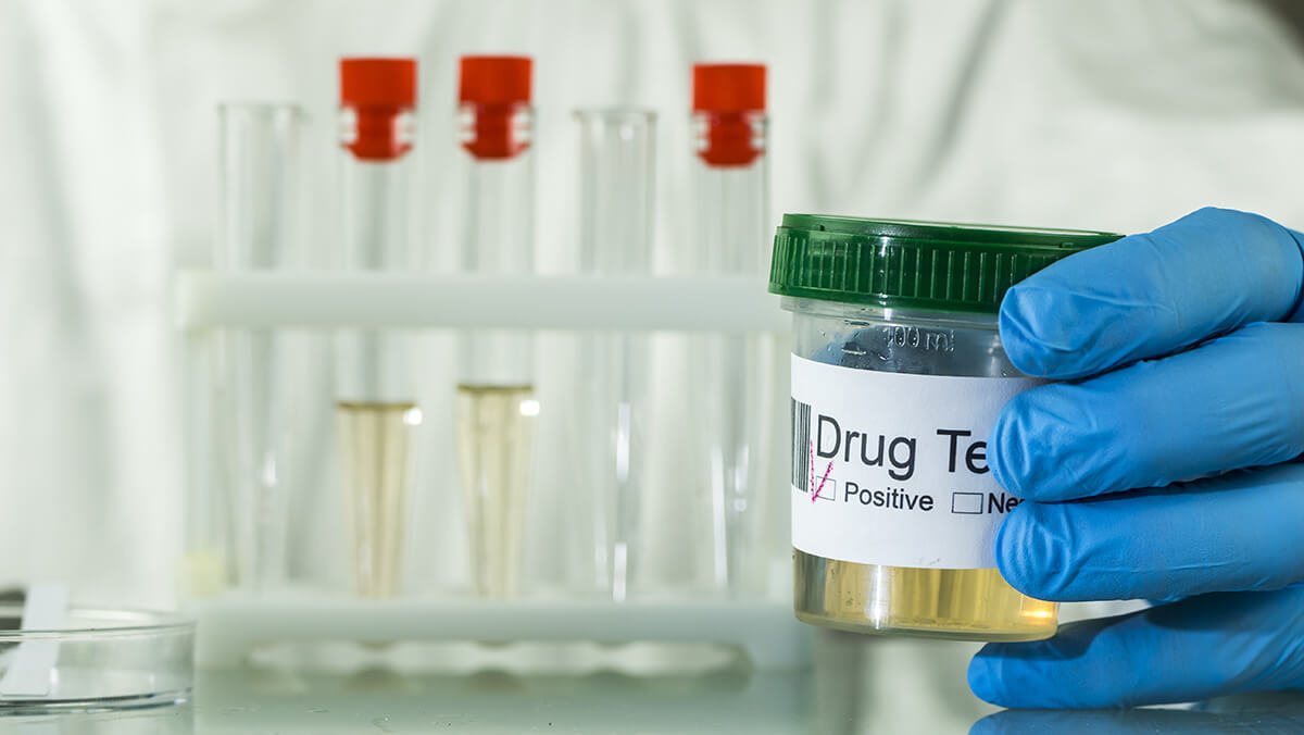 Drug test specimen marked as positive