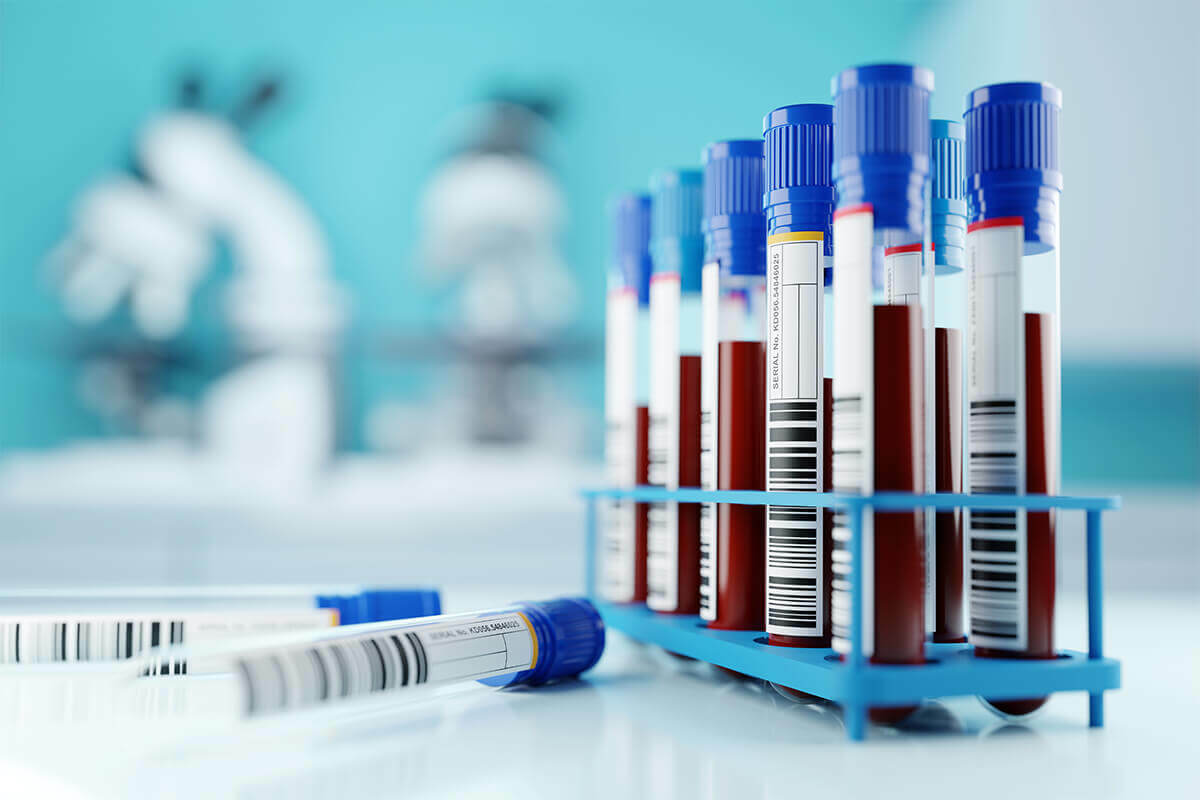 Test tubes with blood specimens sitting in a rack