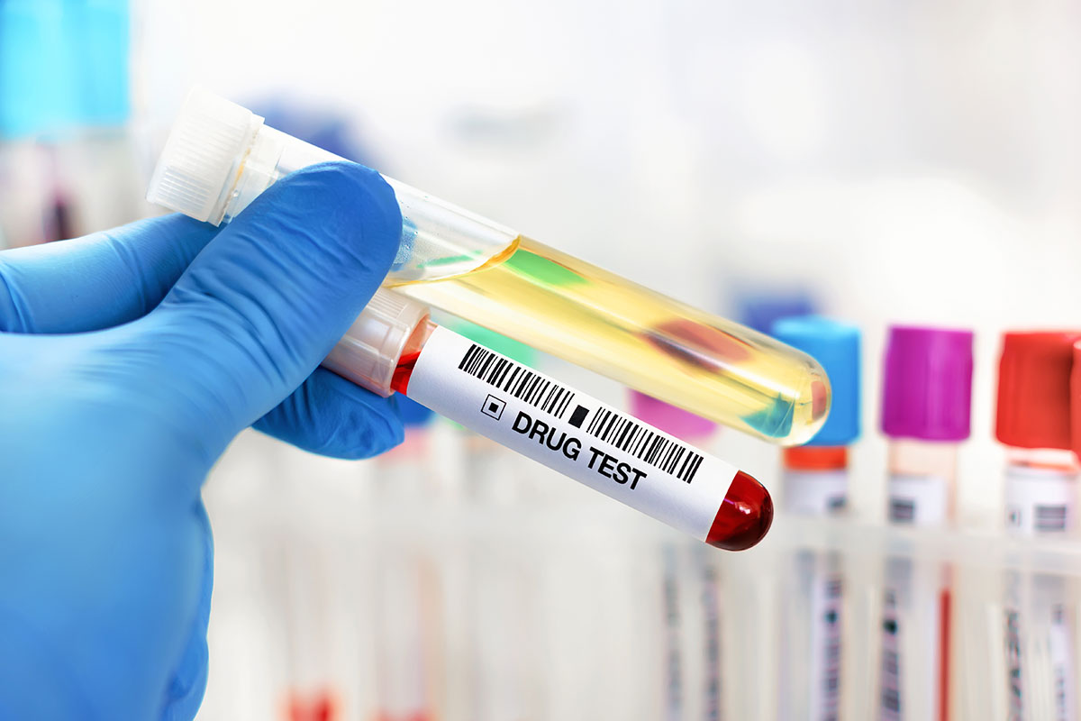 lab tech hand holding urine and blood tube test for analysis for doping or drugs. urinalysis and blood sample for drug test or alcohol in the laboratory