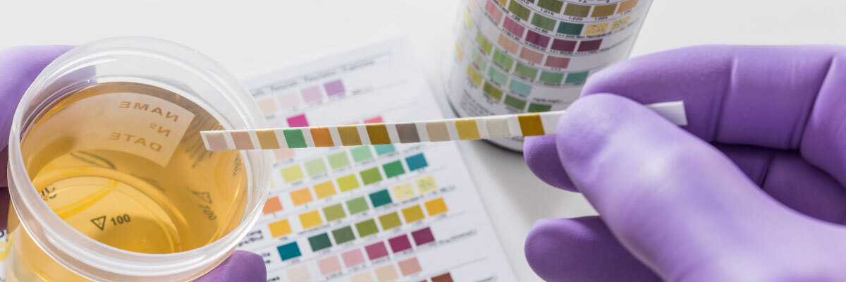 Drug Testing Strips