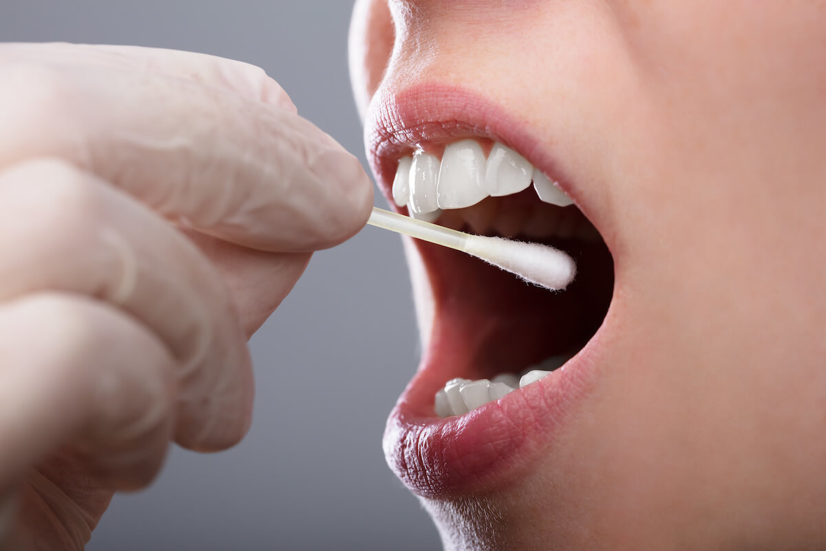 oral fluid sample